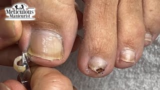 Mr Meticulous Deep Sidewall Cleaning Ingrown Prevention [upl. by Marston]