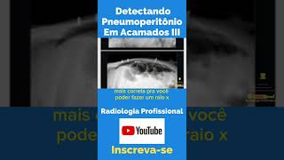 Detectando Pneumoperitônio em Acamados III shorts tecnologoemradiologia radiologia [upl. by Neeloj]