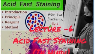 AFB Acid Fast Staining for MTuberculosis Bacillus staining medical viralvideoyoutube [upl. by Layod]