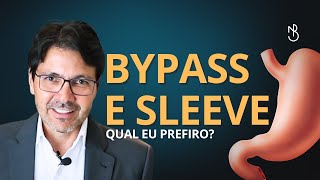 Não Decida sem Assistir Bypass vs Sleeve Gástrico Explicado [upl. by Ahsoyem]