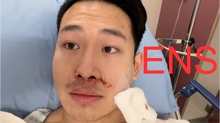 Septoplasty and Turbinate Reduction 2 Month Recovery and Review [upl. by Rivi305]