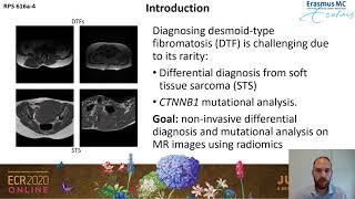 Distinguishing desmoidtype fibromatosis from soft tissue sarcoma on MRI using a radiomics approach [upl. by Nnyltiak]