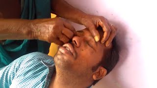 Amazing technique to remove quotDust and Stone  eye cleaning in india  part 2 [upl. by Suzzy]