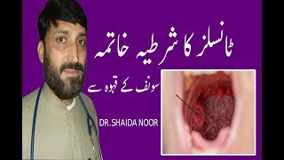 Tonsils ka Desi ilaj in Urdu  home Remedies for Tonsillitis [upl. by Luapnaej]