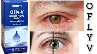 ofly v eye drop uses in urdu Hindi👁️ [upl. by Lyrej]