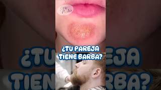 Cuida tu BARBA o causarás ESTO ✌🏻 más en IG medicina sabiasque curiosidades [upl. by Conias]