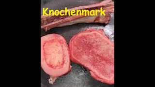 Knochengewebe Teil 4  Knochenmark [upl. by Oiramel579]