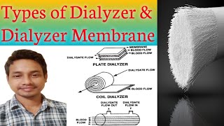 DIALYZER  Types of Dialyzer and Dialyzer membrane  Dialyzer Membrane [upl. by Burack]