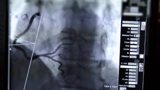 A Stent in Time Saves Lives [upl. by Cheung469]