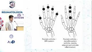 Presentación de casos Clínicos Reumatología [upl. by Davida]