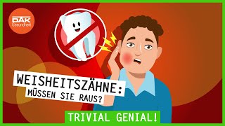 Weisheitszähne Müssen sie raus  trivialgenial  DAKGesundheit [upl. by Gradeigh]