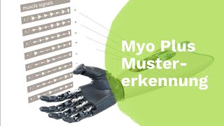 Myo Plus Mustererkennung I Ottobock [upl. by Elehcin980]