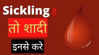 Sickling है तो शादी इनसे करे।Sickle cell anemia [upl. by Aydne633]