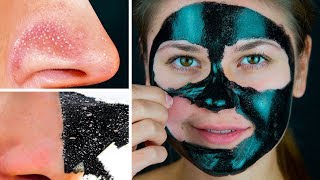 11 Masques Pour le Visage Faciles Avec 2 Ingrédients à Préparer en Une Minute [upl. by Ardnola126]