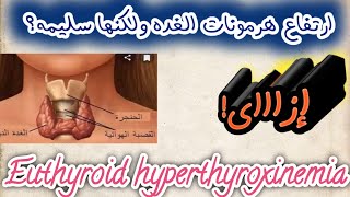 Euthyroid hyperthroxinemia ازااى؟؟ الغده الدرقيه سليمه ولكن فى ارتفاع فى هرموناتها موضوع مهم [upl. by Mile570]