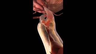 Carotid Arteries Under Attack How Plaque Leads to Stroke medicine anatomy shorts [upl. by Schargel]