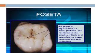 Video conferencia Morfologia dental [upl. by Remled409]