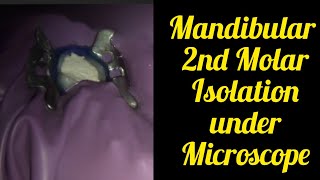 How to Place Rubber Dam in Mandibular Second Molar under Microscope [upl. by Yaya]