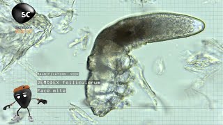 The Science of Bacteria  Life on Us [upl. by Ellenehs]