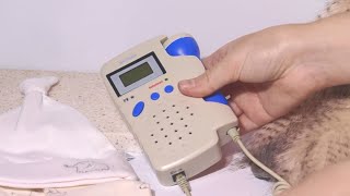 Advanced Fetal Doppler  Hear your babys heartbeat in the comfort of home  BabyHeart Australia [upl. by Nicram441]