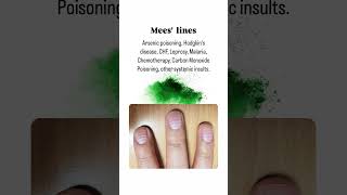 Common Nail Diseases You Should Know About NailHealthNailCareFungalInfectionNailPsoriasis [upl. by Haslam977]