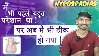 Successful Hypospadias Surgeon in Kolkata  मूत्र का छिद्र सही जगह पर न खुलने की समस्या  Dr Nagwani [upl. by Ymirej]