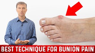 Bunion Pain Relief – The Simple amp Best Technique by DrBerg [upl. by Wolfram]