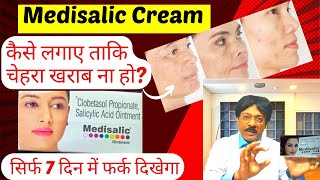 Medisalic cream Medisalic cream ke fayde  Medisalic Cream For Fairness  Safe or Not Review Hindi [upl. by Chrotoem]