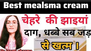 MELX melasma cream full review in hindi  झाईयों को साफ करने की बेस्ट होम्योपैथिक क्रीम [upl. by Dareg]