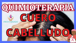 QUIMIOTERAPIA Y CUERO CABELLUDO [upl. by Sydney]