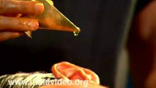 Ayurveda treatment for Ear  Karnapoorana [upl. by Wilburn570]