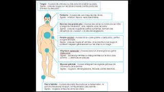 Traitements Naturel Des Mycoses [upl. by Adnoma]