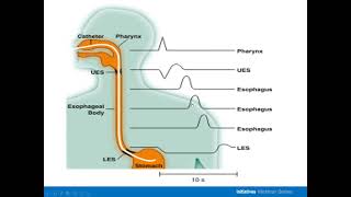 What Every Nurse Needs to Know about High Resolution Manometry [upl. by Alamat]