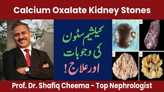 Calcium Oxalate Kidney Stones  Causes amp Treatment by The Best Nephrologist in Lahore [upl. by Nylevol]