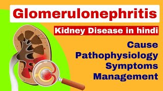 Glomerulonephritis  Nephritis in hindi  kidney disease  medical surgical nursing lecture [upl. by Rashidi965]