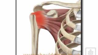 subacromial impingement aetiologymp4 [upl. by Hpejsoj]