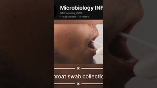 Throat swab specimen collection neet  studygram exam upsc ias biology studymotivation [upl. by Olihs]