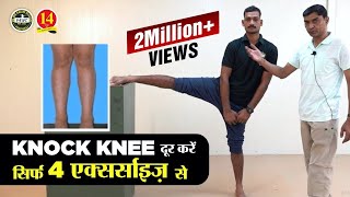 What is Knock Knee How to solve Knock Knee problem for Medical in Army Air Force and Navy [upl. by Aenert486]