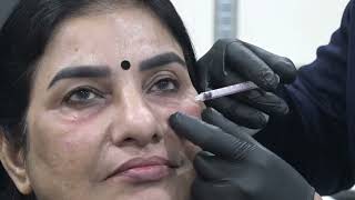 Facematic Trainings Exclusive Masterclass  Facial Aesthetics Training Dr Akshay Bagade facialist [upl. by Kassi]