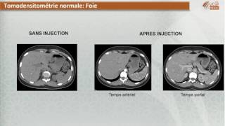 FMPM MOOCs  Radiologie digestive Imagerie du foie  Pr N Cherif Idrissi El Ganouni [upl. by Suixela21]