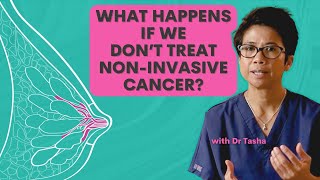 What is DCIS and What Happens if We Dont Treat It  with Dr Tasha [upl. by Boorer]