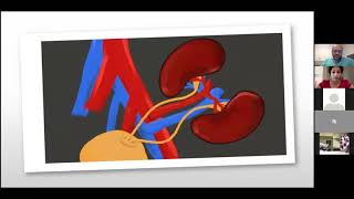 Everything you need to know about renal transplant artery stenosis Dr Ghaneh Fananapazir [upl. by Lorrimor]