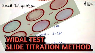 Widal test slide titrationdilution methodProcedure and result interpretation in an easy way [upl. by Sorenson118]