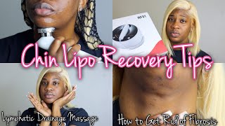 How To Get Rid Of Fibrosis For Chin Lipo Post OP Care amp Products Lymphatic Drainage Massage At Home [upl. by Nerraf652]