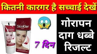 Skinkler cream 2025Skinkler Cream Side EffectsSkinkler Cream Review [upl. by Namaj]