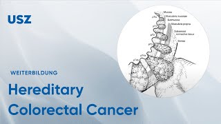 Hereditary Colorectal Cancer – Please participate in our 3minute survey below [upl. by Surovy]