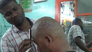 AMAZING AND WEIRD DANDRUFF HEAD SHAVE How to a Dandruff head shave CS ASMR [upl. by Llennehc]