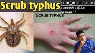 Scrub typhus in tamilmedical awareness in tamil [upl. by Ettedo]