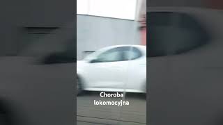 Choroba lokomocyjna [upl. by Averill]