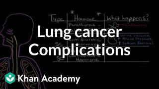 Lung cancer complications  Respiratory system diseases  NCLEXRN  Khan Academy [upl. by Rudelson]